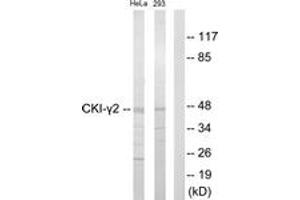 Western blot analysis of extracts from HeLa/293 cells, using CKI-gamma2 Antibody. (Casein Kinase 1 gamma 2 抗体  (AA 10-59))