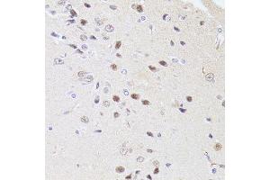 Immunohistochemistry of paraffin-embedded rat brain using DMAP1 antibody. (DMAP1 抗体  (AA 1-305))