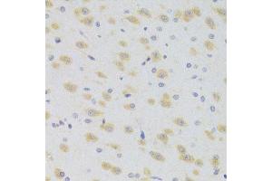 Immunohistochemistry (Paraffin-embedded Sections) (IHC (p)) image for anti-SCO2 Cytochrome C Oxidase Assembly Protein (SCO2) (AA 1-130) antibody (ABIN6147457)