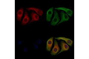 ABIN7094032 and ABIN7098076 staining Hela cells by IF/ICC. (TXNDC5 抗体  (N-Term))