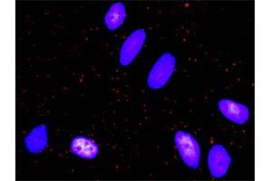 Proximity Ligation Analysis of protein-protein interactions between EGFR and FOS. (c-FOS 抗体  (AA 1-380))