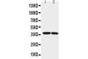 Anti-IGFBP1 antibody, Western blotting Lane 1: SMMC Cell Lysate Lane 2: MCF-7 Cell Lysate (IGFBPI 抗体  (Middle Region))