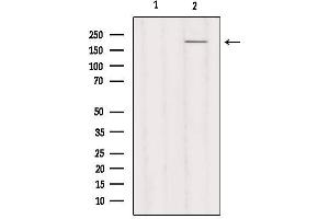 Western blot analysis of extracts from Hela, using MYH3 Antibody. (MYH3 抗体  (C-Term))