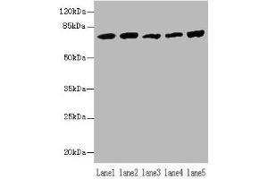 Western blot All lanes: Hspa1b antibody at 5 μg/mL Lane 1: A431 whole cell lysate Lane 2: A549 whole cell lysate Lane 3: Jurkat whole cell lysate Lane 4: MCF-7 whole cell lysate Lane 5: K562 whole cell lysate Secondary Goat polyclonal to rabbit IgG at 1/10000 dilution Predicted band size: 71 kDa Observed band size: 71 kDa (HSPA1B 抗体  (AA 2-642))