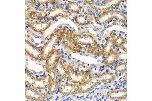 Immunohistochemistry of paraffin-embedded mouse kidney using ZFAND3 antibody (ABIN5975562) at dilution of 1/100 (40x lens). (ZFAND3 抗体)