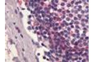 Anti-S1PR4 / EDG6 antibody IHC of human lymph node. (S1PR4 抗体  (C-Term))