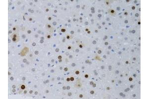 Immunohistochemistry of paraffin-embedded mouse liver using PCNA antibody (ABIN5970094) at dilution of 1/100 (40x lens). (PCNA 抗体)