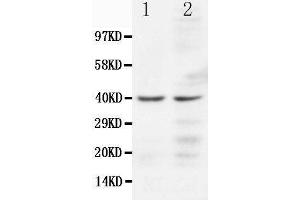 Anti-CCR5 antibody, Western blotting Lane 1: JURKAT Cell Lysate Lane 2: COLO320 Cell Lysate (CCR5 抗体  (N-Term))