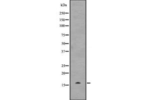 Western blot analysis of UBE2D3 expression in Hela cell lysate,The lane on the left is treated with the antigen-specific peptide. (UBE2D3 抗体)
