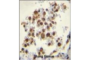 CYP5A1 Antibody (Center) (ABIN656016 and ABIN2845391) immunohistochemistry analysis in formalin fixed and paraffin embedded human lung tissue followed by peroxidase conjugation of the secondary antibody and DAB staining. (TBXAS1 抗体  (AA 226-257))