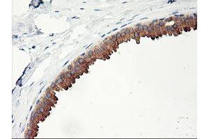 Immunohistochemical staining of paraffin-embedded Human breast tissue using anti-PHF21B mouse monoclonal antibody. (PHF21B 抗体)