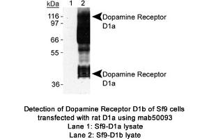 Image no. 1 for anti-Dopamine Receptor D1 (DRD1) (C-Term) antibody (ABIN363247) (Dopamine Receptor d1 抗体  (C-Term))