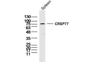 Mouse spleen lysates probed with CRSP77 Polyclonal Antibody, unconjugated  at 1:300 overnight at 4°C followed by a conjugated secondary antibody at 1:10000 for 90 minutes at 37°C. (MED17 抗体  (AA 181-280))