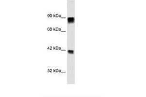 Image no. 1 for anti-Retinoblastoma Protein (Rb Protein) (AA 703-752) antibody (ABIN6735939) (Retinoblastoma Protein (Rb) 抗体  (AA 703-752))