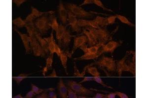 Immunofluorescence analysis of HeLa cells using TLR3 Polyclonal Antibody at dilution of 1:100. (TLR3 抗体)