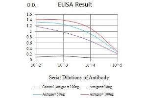 Black line: Control Antigen (100 ng),Purple line: Antigen (10 ng), Blue line: Antigen (50 ng), Red line:Antigen (100 ng) (MSH6 抗体  (AA 217-395))