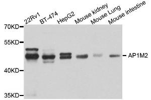 Western blot analysis of extracts of various cell lines, using AP1M2 antibody. (AP1m2 抗体  (AA 164-423))