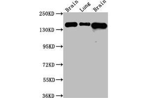 Western Blot Positive WB detected in: Rat Brain whole cell lysate, Rat Lung whole cell lysate, Mouse Brain whole cell lysate All lanes: FGFR2 Antibody at 1:1000 Secondary Goat polyclonal to rabbit IgG at 1/50000 dilution Predicted band size: 93, 87, 93, 77, 92, 89, 86, 29, 80, 93, 97, 92, 41, 80, 80, 77, 80 kDa Observed band size: 145 kDa (Recombinant FGFR2 抗体)