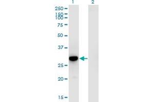 Western Blot analysis of RFXANK expression in transfected 293T cell line by RFXANK monoclonal antibody (M01), clone 4G10.