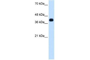 WB Suggested Anti-ZSCAN16 Antibody Titration:  0. (ZSCAN16 抗体  (N-Term))