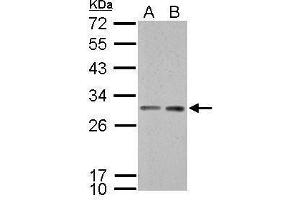 Western Blotting (WB) image for anti-Stratifin (SFN) (C-Term) antibody (ABIN2854692)
