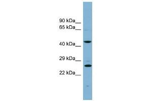 VPS28 antibody used at 1 ug/ml to detect target protein. (VPS28 抗体)
