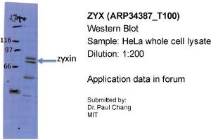 Sample Type: HeLa whole cell lysatePrimary Dilution: 1:200 (ZYX 抗体  (Middle Region))