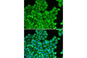 Immunofluorescence analysis of HeLa cell using CSRP1 antibody. (CSRP1 抗体)