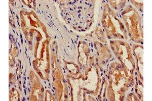 Immunohistochemistry of paraffin-embedded human kidney tissue using ABIN7153530 at dilution of 1:100 (BBOX1 抗体  (AA 154-247))