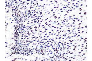 Immunohistochemistry of paraffin-embedded human esophageal using DDB1 Rabbit mAb (ABIN7266673) at dilution of 1:100 (40x lens). (DDB1 抗体)