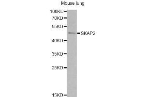 Western blot analysis of extracts of mouse lung, using SKAP2 antibody. (SKAP2 抗体)