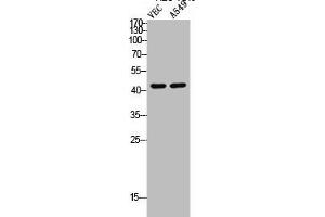 Western Blot analysis of VEC A549 cells using Cleaved-MMP-12 (G106) Polyclonal Antibody (MMP12 抗体  (Cleaved-Gly106))