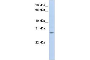 WB Suggested Anti-IGFBP4 Antibody Titration:  1 ug/ml  Positive Control:  Fetal Brain Lysate (IGFBP4 抗体  (Middle Region))