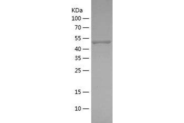 PRKAA2 Protein (AA 340-552) (His-IF2DI Tag)