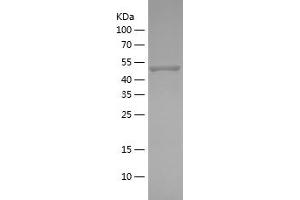 Western Blotting (WB) image for Protein Kinase, AMP-Activated, alpha 2 Catalytic Subunit (PRKAA2) (AA 340-552) protein (His-IF2DI Tag) (ABIN7124658) (PRKAA2 Protein (AA 340-552) (His-IF2DI Tag))