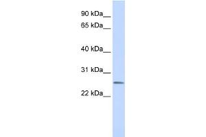 WB Suggested Anti-CEACAM4 Antibody Titration:  0. (CEACAM4 抗体  (N-Term))
