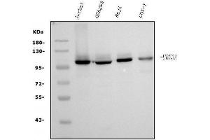 Western blot analysis of UBE3A using anti-UBE3A antibody (ABIN7599563).