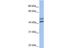 WB Suggested Anti-GALT Antibody Titration:  0. (GALT 抗体  (C-Term))