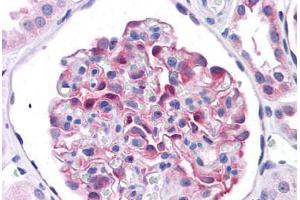 Human Kidney: Formalin-Fixed, Paraffin-Embedded (FFPE) (LRRC59 抗体  (AA 201-250))