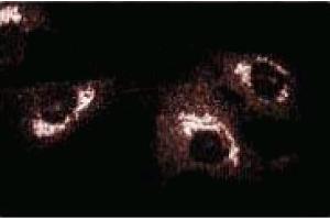 Immunofluorescence staining of BC3H1 cells (Mouse brain smooth muscle-like cells, ATCC CRL-1443). (GBF1 抗体  (AA 1266-1379))