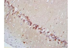 Formalin-fixed and paraffin embedded mouse brain labeled with Rabbit Anti-MAPKAPK2 (Thr222) Polyclonal Antibody, Unconjugated  at 1:200 followed by conjugation to the secondary antibody and DAB staining (MAPKAP Kinase 2 抗体  (pThr222))
