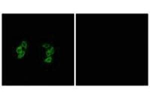 Immunofluorescence analysis of A549 cells, using CKI-α1/L antibody. (CSNK1A1L/CSNK1A1 抗体)