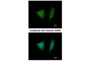 ICC/IF Image Immunofluorescence analysis of methanol-fixed HeLa, using EIF3 beta, antibody at 1:200 dilution. (EIF3I 抗体)