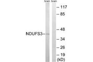 Western blot analysis of extracts from mouse brain cells, using NDUFS3 Antibody. (NDUFS3 抗体  (AA 117-166))