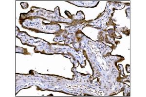 IHC analysis of LRP1B using anti-LRP1B antibody (ABIN7601521). (LRP1B 抗体  (AA 3704-4547))