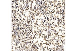 IHC analysis of Epac1/RAPGEF3 using anti-Epac1/RAPGEF3 antibody (ABIN7601858).