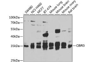 Western blot analysis of extracts of various cell lines, using CBR3 antibody  at 1:1000 dilution. (CBR3 抗体  (AA 118-277))