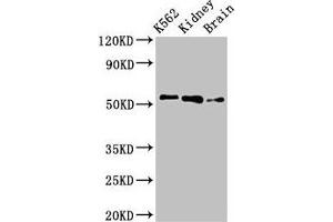 Western Blot Positive WB detected in: K562 whole cell lysate, Rat kidney tissue, Rat brain tissue All lanes: PFKFB2 antibody at 3 μg/mL Secondary Goat polyclonal to rabbit IgG at 1/50000 dilution Predicted band size: 59, 55 kDa Observed band size: 55 kDa (PFKFB2 抗体  (AA 360-505))