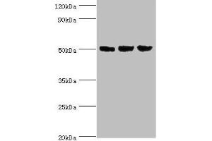Western blot All lanes: ORC4 antibody at 4 μg/mL Lane 1: Hela whole cell lysate Lane 2: Jurkat whole cell lysate Lane 3: A549 whole cell lysate Secondary Goat polyclonal to rabbit IgG at 1/10000 dilution Predicted band size: 51, 41, 43 kDa Observed band size: 51 kDa (ORC4 抗体  (AA 187-436))
