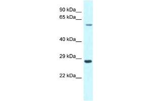 WB Suggested Anti-CPNE3 Antibody Titration: 1. (Copine III 抗体  (C-Term))